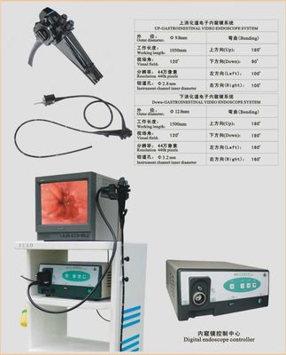 上消化道電子內窺鏡 現代醫學的“明亮之眼”